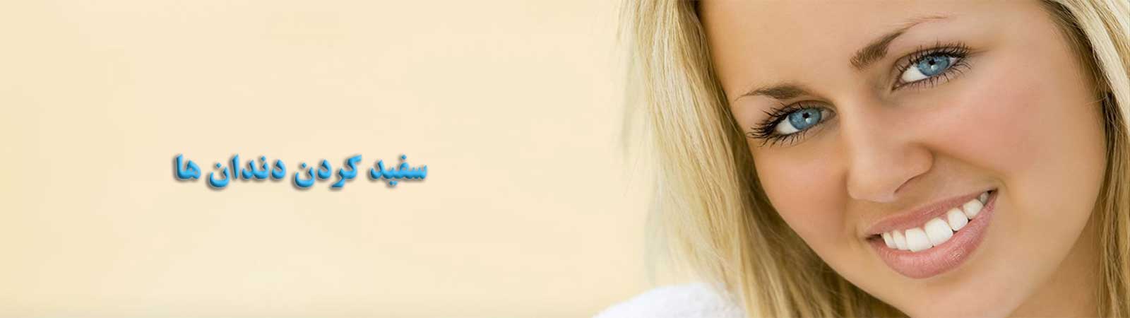 سفید کردن دندان طالقانی