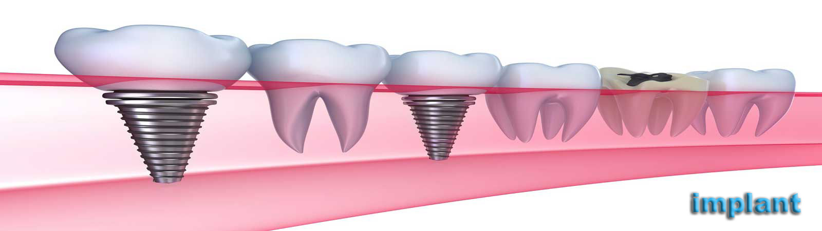 dr vahid ameli dentalclinic